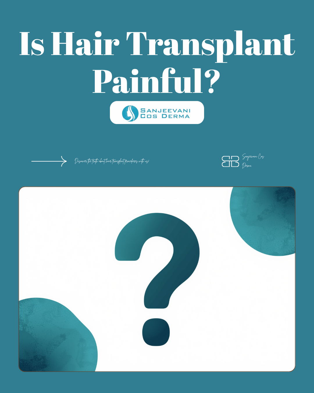 Is Hair Transplant Painful? — Sanjeevani Cos Derma